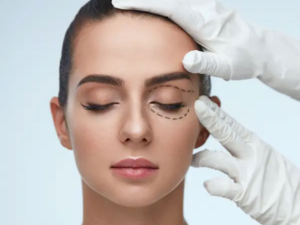 Eyelid surgery
