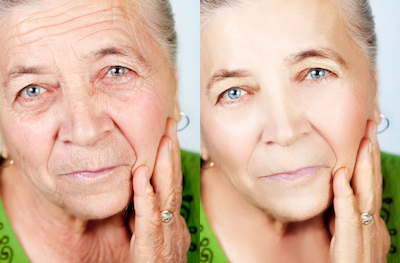 reduce-facial-ageing